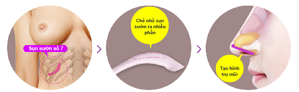 nang mui cau truc sun suon
