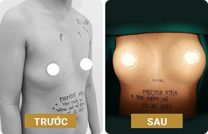 nang-nguc-tui