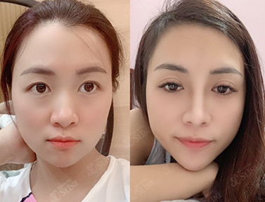 nhan mi 7 diem
