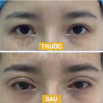 hinh anh cat mi han quoc 3